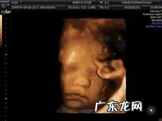 孕5个月的胎儿会是什么样子的?
