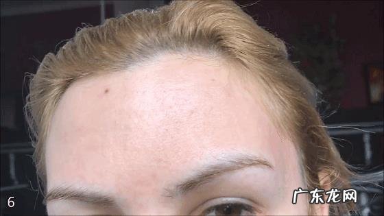 彩光嫩肤、点阵激光、光子嫩肤有什么区别？