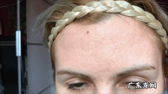 彩光嫩肤、点阵激光、光子嫩肤有什么区别？