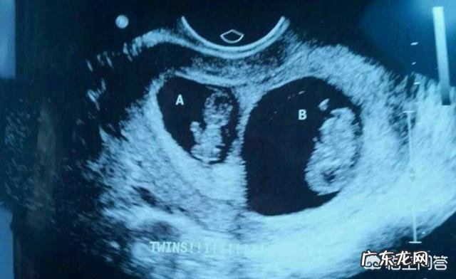 怀双胞胎的人要注意什么?