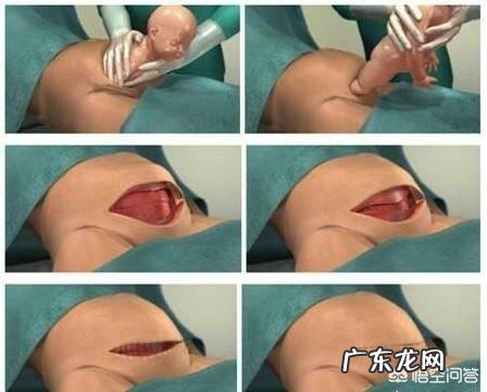 女人生孩子到底有多疼？