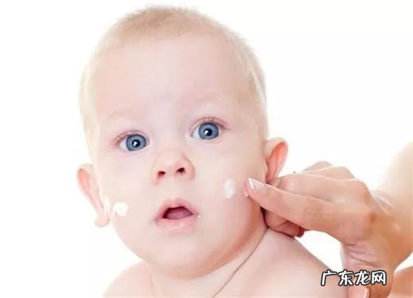婴幼儿湿疹可以使用药膏吗?