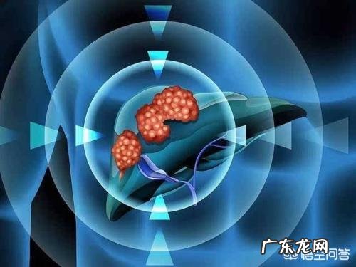 乙肝大三阳怀孕了该怎么办?