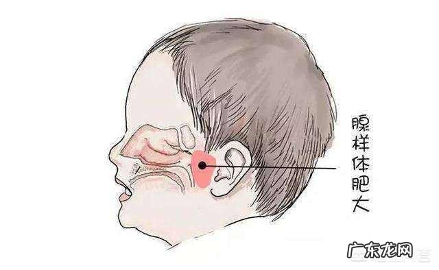 新生儿打呼噜是什么原因?