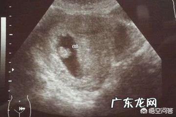 怀孕多久才能看见胎心?