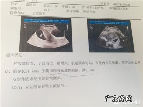 怀孕多久才能看见胎心?