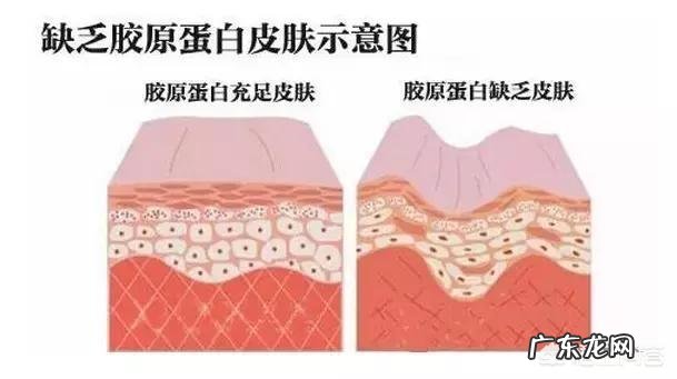 光子嫩肤能维持多长时间，有副作用吗？