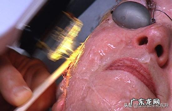 光子嫩肤能维持多长时间，有副作用吗？