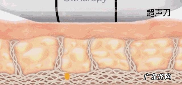 眼睛出现皱纹了,祛除眼睛皱纹的方法是什么?