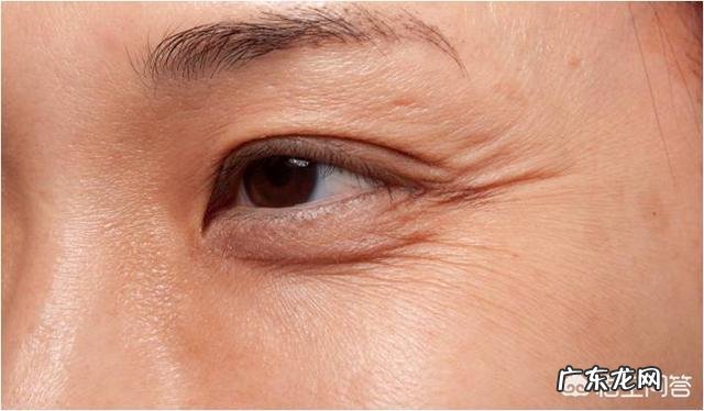 眼睛出现皱纹了,祛除眼睛皱纹的方法是什么?