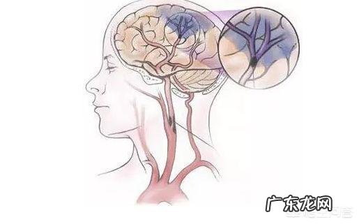 有私人中医大夫认为在舌头底下放血能防止脑血栓，有科学依据吗？