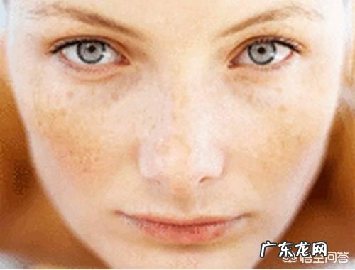 怎样祛斑才是最有效、最安全的？