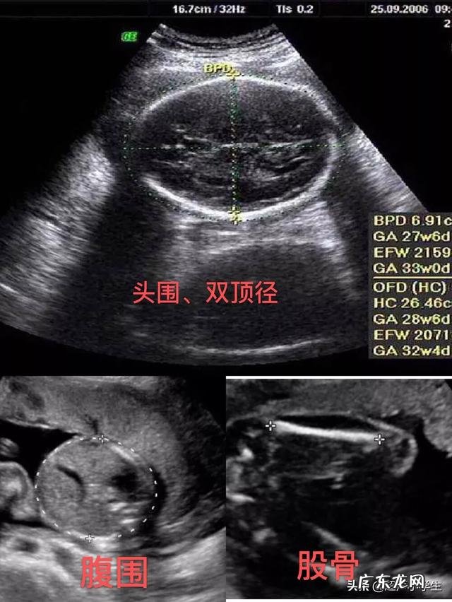 预产期是自己算还是按B超单子算?