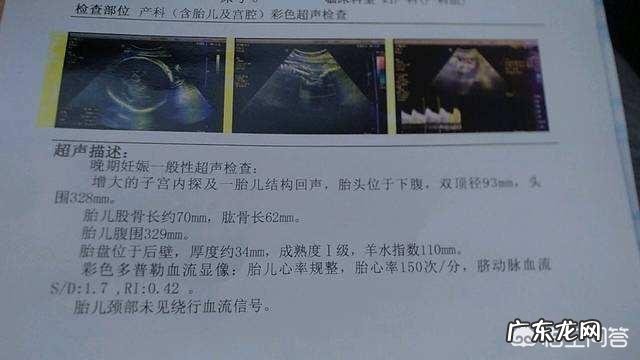 预产期是自己算还是按B超单子算?