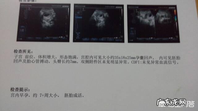 预产期是自己算还是按B超单子算?