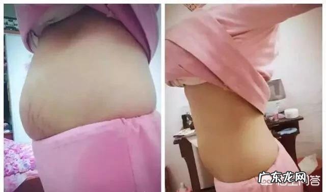 产妇如何下奶快?