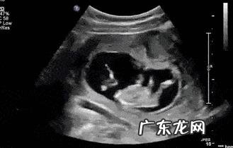 怀孕四个月B超准吗?