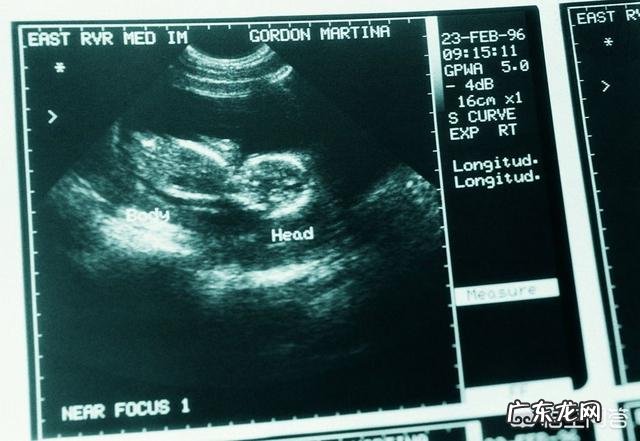 怀孕四个月B超准吗?