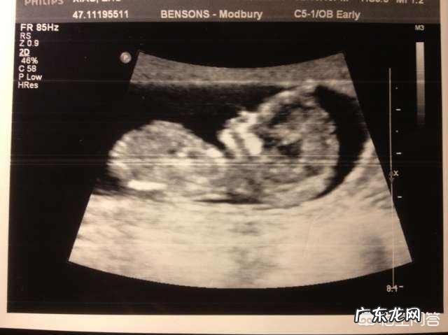怀孕四个月B超准吗?