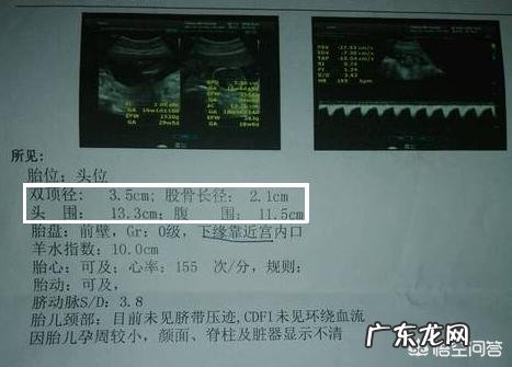怀孕四个月B超准吗?