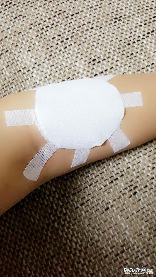 贴了三伏贴后皮肤会发痒,是什么原因?