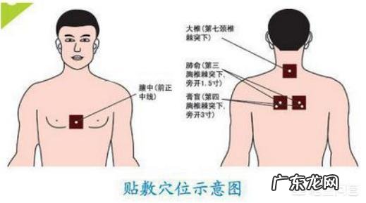 贴了三伏贴后皮肤会发痒,是什么原因?