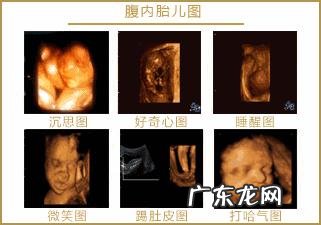 四维彩超都做,既然生出是唐氏综合症宝宝而且有先心病,医院有责任吗?