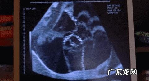 怀孕7个半月,还要做几次产检?有什么注意事项?