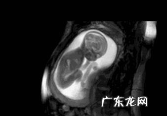 怀孕7个半月,还要做几次产检?有什么注意事项?