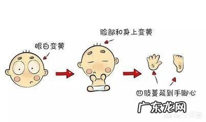 婴儿黄疸正常值是多少?