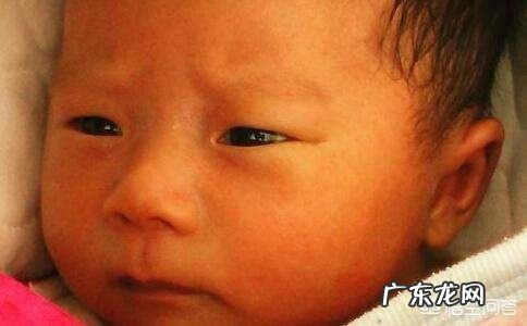 婴儿黄疸正常值是多少?