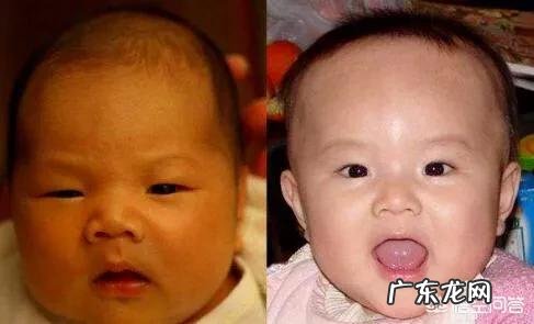 婴儿黄疸正常值是多少?