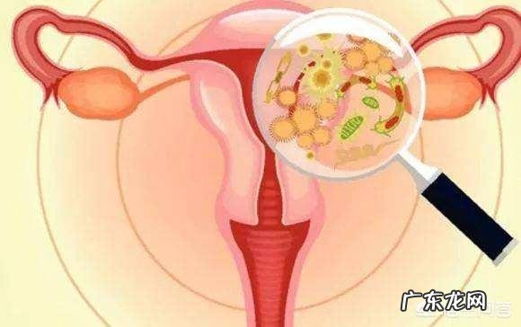 有卵泡不排卵怎么回事？