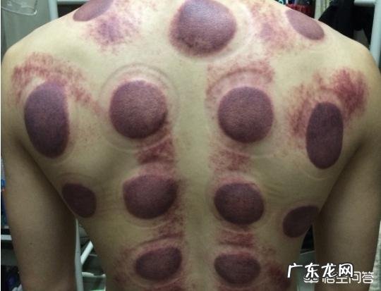 广州黑医馆“放血疗法”治百病,半年就有2000人就诊,你怎么看?