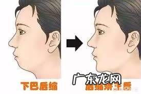 有双下巴怎么才能减掉?