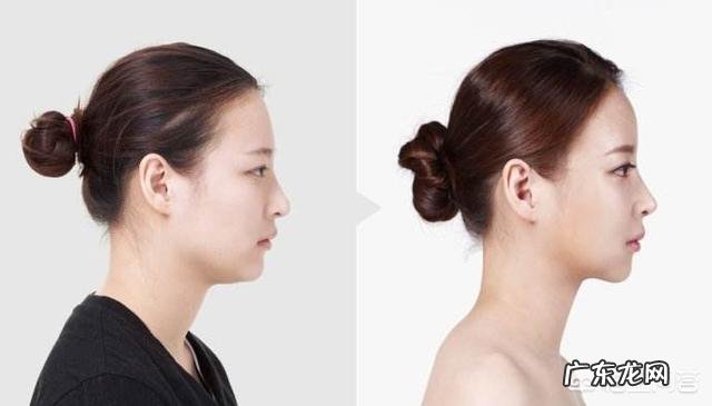 有双下巴怎么才能减掉?