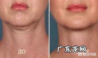 有双下巴怎么才能减掉?