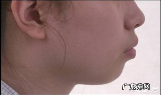 有双下巴怎么才能减掉？