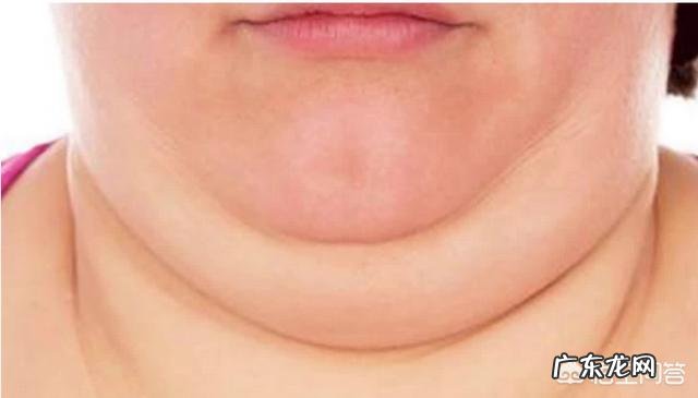有双下巴怎么才能减掉？