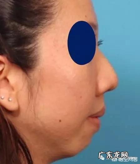 有双下巴怎么才能减掉？