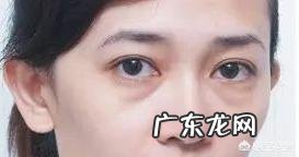 有眼袋是什么原因?
