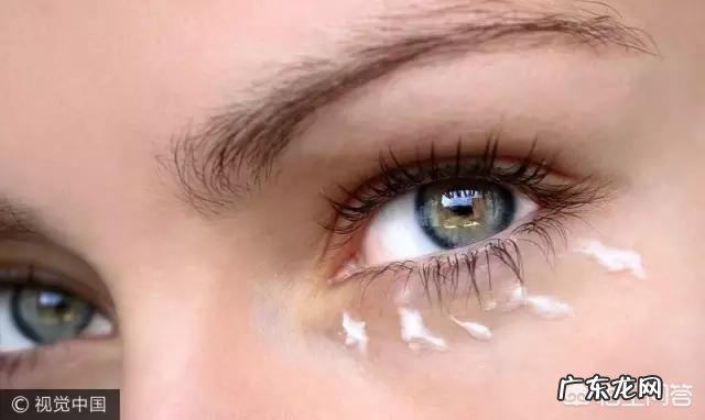 有眼袋是什么原因?