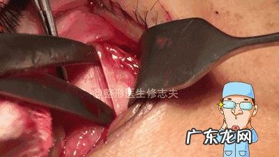 有眼袋是什么原因?