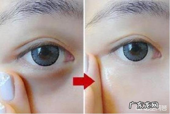 有眼袋是什么原因?