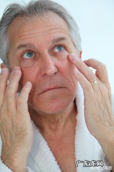 有眼袋是什么原因?