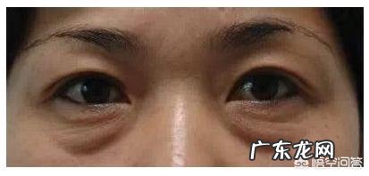 有眼袋是什么原因?