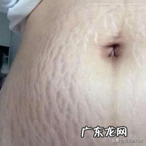 怀孕多久会长妊娠纹?为什么会长妊娠纹?