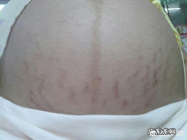 怀孕多久会长妊娠纹?为什么会长妊娠纹?