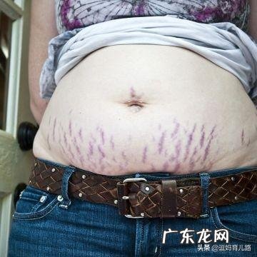 怀孕多久会长妊娠纹?为什么会长妊娠纹?