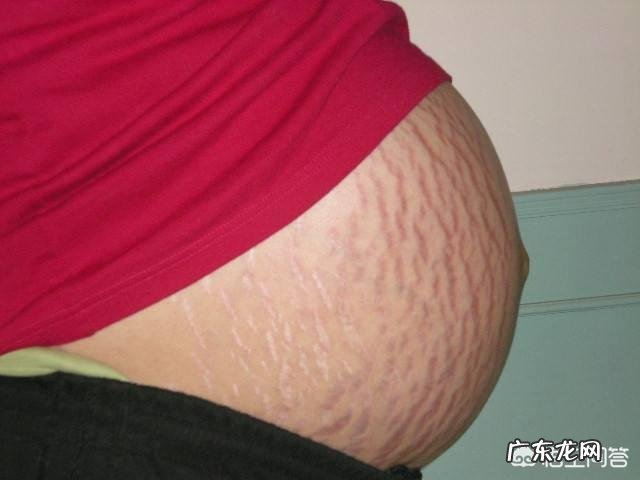 怀孕多久会长妊娠纹?为什么会长妊娠纹?